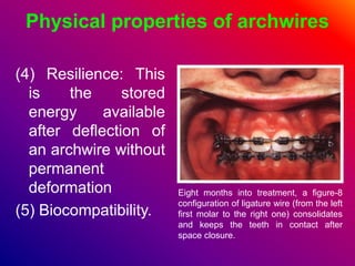Physical properties of archwires
(4) Resilience: This
is the stored
energy available
after deflection of
an archwire without
permanent
deformation
(5) Biocompatibility.
Eight months into treatment, a figure-8
configuration of ligature wire (from the left
first molar to the right one) consolidates
and keeps the teeth in contact after
space closure.
 