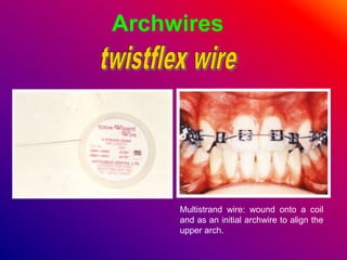 Archwires
Multistrand wire: wound onto a coil
and as an initial archwire to align the
upper arch.
 