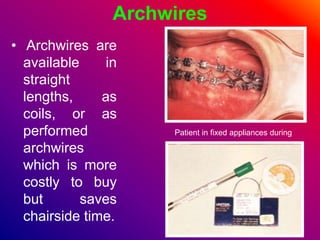 Archwires
• Archwires are
available in
straight
lengths, as
coils, or as
performed
archwires
which is more
costly to buy
but saves
chairside time.
Patient in fixed appliances during
 