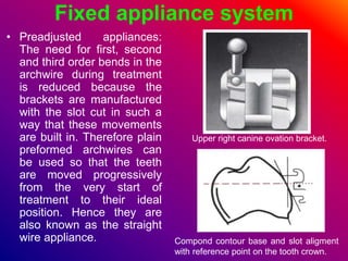 Fixed appliance system
• Preadjusted appliances:
The need for first, second
and third order bends in the
archwire during treatment
is reduced because the
brackets are manufactured
with the slot cut in such a
way that these movements
are built in. Therefore plain
preformed archwires can
be used so that the teeth
are moved progressively
from the very start of
treatment to their ideal
position. Hence they are
also known as the straight
wire appliance.
Upper right canine ovation bracket.
Compond contour base and slot aligment
with reference point on the tooth crown.
 