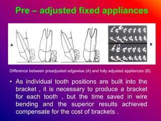 Pre – adjusted fixed appliances
• As individual tooth positions are built into the
bracket , it is necessary to produce a bracket
for each tooth , but the time saved in wire
bending and the superior results achieved
compensate for the cost of brackets .
Difference between preadjusted edgewise (A) and fully adjusted appliances (B).
 
