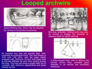 Looped archwire
Space-holding loop, which may be adjusted
for vertical or horizontal movements.
Box loop, activated. Vertical arms may also
be formed to engage the brackets of
adjacent teeth for space opening.
An inverted box loop will provide light, well-
controlled buccolingual force. The wire shown is
.018 inch (.45 mm), with the base tightly
wrapped with ,020-inch (.5-mm) soft brass wire
to provide stiffness for arch form control across
the loop. This loop will move a single tooth out of
crossbite with minimum adjustments and good
vertical control.
A delta-shaped loop, with or without the
helices shown here, provides good
flexibility in all vertical and horizontal
directions.
 