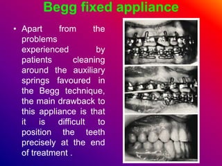 Begg fixed appliance
• Apart from the
problems
experienced by
patients cleaning
around the auxiliary
springs favoured in
the Begg technique,
the main drawback to
this appliance is that
it is difficult to
position the teeth
precisely at the end
of treatment .
 