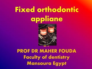 Fixed orthodontic
appliane
BY
PROF DR MAHER FOUDA
Faculty of dentistry
Mansoura Egypt
 