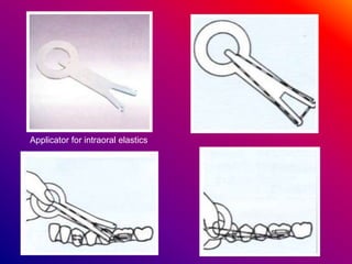 Applicator for intraoral elastics
 