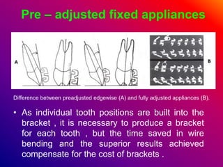 Pre – adjusted fixed appliances
• As individual tooth positions are built into the
bracket , it is necessary to produce a ...