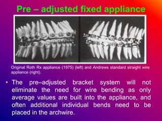 Pre – adjusted fixed appliance
• The pre–adjusted bracket system will not
eliminate the need for wire bending as only
aver...
