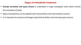  Overjet correction and space closure is undertaken in large rectangular wires which control
the inclination of teeth.
 Space closing forces can be applied with intramaxillary and intermaxillary traction.
 It is important to reassess anchorage requirements before commencing space closure.
Stages of orthodontic treatment
 