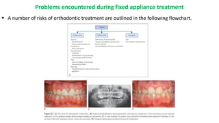  A number of risks of orthodontic treatment are outlined in the following flowchart.
Problems encountered during fixed appliance treatment
 
