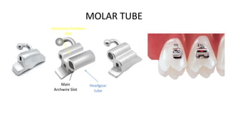MOLAR TUBE
Accessory Archwire
Slot

Main
Archwire Slot

Headgear
tube

 