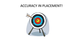 ACCURACY IN PLACEMENT!

 
