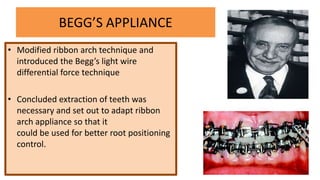 BEGG’S APPLIANCE
• Modified ribbon arch technique and
introduced the Begg’s light wire
differential force technique
• Concluded extraction of teeth was
necessary and set out to adapt ribbon
arch appliance so that it
could be used for better root positioning
control.

 