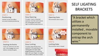 SELF LIGATING
BRACKETS
‘’A bracket which
utilizes a
permanently
installed , movable
component to
entrap the arch
wire.’’

 