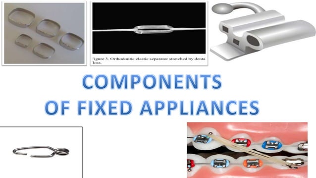Fixed appliances in orthodontics | PPTX