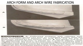 ARCH FORM AND ARCH WIRE FABRICATION

 