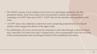 101
• The MARA consists of four stainless steel crowns (or rigid bands) attached to the first
permanent molars. Each lower molar crown incorporates a double tube soldered on it,
consisting of a 0.045′′ tube and a 0.022 × 0.028′′ tube for the maxillary and mandibular arch
wires.
• A 0.059′′ arm is also soldered to each lower crown, projecting perpendicular to its buccal
surface, which engages the elbows of the upper molar.
• For stabilization, the lower crowns can be connected to each other through a soldered lingual
arch, especially if no braces are used. A lingual arch is also recommended to prevent crowding
of the second premolars and mesiolingual rotation of the mandibular first molars
 