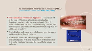 107
The Mandibular Protraction Appliance (MPA)
(Carlos Martin Coelho Filho-1995, 1997, 1998)
 The Mandibular Protraction Appliance (MPA) evolved
in the mid 1990s in an effort to mimic attached
functional appliances for the correction of Class II
malocclusions that patients could not easily remove, and
that clinicians could make without laboratory expense or
additional inventory.
 The MPA has undergone several changes over the years
and is now in its fourth variation.
 It functions much like a Herbst appliance but uses
smaller tubes and rods and these attach to the maxillary
first molar headgear tube and the mandibular edgewise
archwire.
 