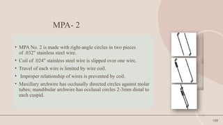109
MPA- 2
• MPA No. 2 is made with right-angle circles in two pieces
of .032" stainless steel wire.
• Coil of .024" stainless steel wire is slipped over one wire.
• Travel of each wire is limited by wire coil.
• Improper relationship of wires is prevented by coil.
• Maxillary archwire has occlusally directed circles against molar
tubes; mandibular archwire has occlusal circles 2-3mm distal to
each cuspid.
 