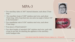 110
MPA-3
• Two maxillary tubes of .045" internal diameter, each about 27mm
long •
• Two maxillary loops of .040" stainless steel wire, each about
13mm long, with a loop bent into one end at an angle of about 130°
to the horizontal •
• Two mandibular rods of .036" stainless steel wire, each about
27mm long •
• Four pieces of band material •
• Two short lengths of annealed .036" stainless steel wire, each with
a loop in one end, for attaching the appliance to the maxillary
molar headgear tube
Carlos Martins Coelho Filho. Mandibular Protraction Appliance No. 3 JCO june1998
 