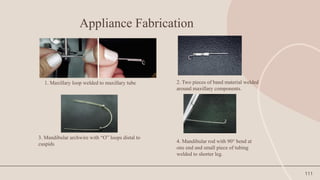 111
Appliance Fabrication
1. Maxillary loop welded to maxillary tube 2. Two pieces of band material welded
around maxillary components.
3. Mandibular archwire with “O” loops distal to
cuspids
4. Mandibular rod with 90° bend at
one end and small piece of tubing
welded to shorter leg.
 