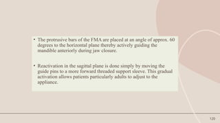 120
• The protrusive bars of the FMA are placed at an angle of approx. 60
degrees to the horizontal plane thereby actively guiding the
mandible anteriorly during jaw closure.
• Reactivation in the sagittal plane is done simply by moving the
guide pins to a more forward threaded support sleeve. This gradual
activation allows patients particularly adults to adjust to the
appliance.
 