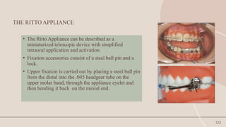 122
THE RITTO APPLIANCE
• The Ritto Appliance can be described as a
miniaturized telescopic device with simplified
intraoral application and activation.
• Fixation accessories consist of a steel ball pin and a
lock.
• Upper fixation is carried out by placing a steel ball pin
from the distal into the .045 headgear tube on the
upper molar band, through the appliance eyelet and
then bending it back on the mesial end.
 