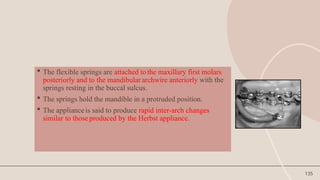 135
 The flexible springs are attached to the maxillary first molars
posteriorly and to the mandibular archwire anteriorly with the
springs resting in the buccal sulcus.
 The springs hold the mandible in a protruded position.
 The appliance is said to produce rapid inter-arch changes
similar to those produced by the Herbst appliance.
 