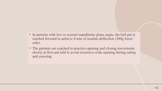 142
• In patients with low or normal mandibular plane angle, the ball pin is
cinched forward to achieve 4 mm of module deflection (300g force/
side).
• The patients are coached to practice opening and closing movements
slowly at first and told to avoid excessive wide opening during eating
and yawning.
 