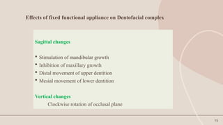 15
Effects of fixed functional appliance on Dentofacial complex
Sagittal changes
 Stimulation of mandibular growth
 Inhibition of maxillary growth
 Distal movement of upper dentition
 Mesial movement of lower dentition
Vertical changes
Clockwise rotation of occlusal plane
 