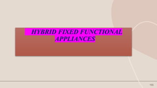 155
HYBRID FIXED FUNCTIONAL
APPLIANCES
 