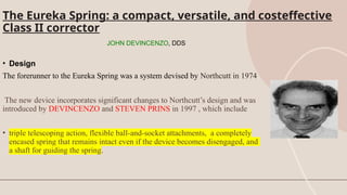The Eureka Spring: a compact, versatile, and costeffective
Class II corrector
JOHN DEVINCENZO, DDS
• Design
The forerunner to the Eureka Spring was a system devised by Northcutt in 1974.
The new device incorporates significant changes to Northcutt’s design and was
introduced by DEVINCENZO and STEVEN PRINS in 1997 , which include
• triple telescoping action, flexible ball-and-socket attachments, a completely
encased spring that remains intact even if the device becomes disengaged, and
a shaft for guiding the spring.
 
