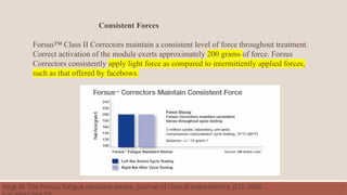 Consistent Forces
Forsus™ Class II Correctors maintain a consistent level of force throughout treatment.
Correct activation of the module exerts approximately 200 grams of force. Forsus
Correctors consistently apply light force as compared to intermittently applied forces,
such as that offered by facebows.
Vogt W. The Forsus fatigue resistant device. Journal of clinical orthodontics: JCO. 2006
 