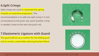 6.Split Crimps
Split crimps are used to reactivate the spring
module as treatment progresses. The
recommendation is to add one split crimp (1.5 mm
of activation) to the push rod, and if another crimp
is needed, move to the next size push rod.
7.Elastomeric Ligature with Guard
The guard will act as a cushion for the sliding push
rod to contact, potentially reducing bracket failure.
Vogt W. The Forsus fatigue resistant device. Journal of clinical orthodontics: JCO. 2006
 