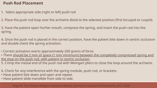 Push Rod Placement
1. Select appropriate side (right or left) push rod
2. Place the push rod loop over the archwire distal to the selected position (first bicuspid or cuspid).
3. Have the patient open his/her mouth, compress the spring, and insert the push rod into the
spring.
4. Once the push rod is placed in the correct position, have the patient bite down in centric occlusion
and double check the spring activation.
• Correct activation exerts approximately 200 grams of force.
• There should be 2 mm of space (1 mm minimum) between the completely compressed spring and
the stop on the push rod, with patient in centric occlusion.
5. Crimp the mesial end of the push rod with Weingart pliers to close the loop around the archwire.
6. Check for any interference with the spring module, push rod, or brackets.
• Have patient bite down and open and repeat.
• Have patient slide mandible from side to side.
Vogt W. The Forsus fatigue resistant device. Journal of clinical orthodontics: JCO. 2006
 