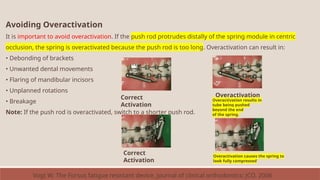 Avoiding Overactivation
It is important to avoid overactivation. If the push rod protrudes distally of the spring module in centric
occlusion, the spring is overactivated because the push rod is too long. Overactivation can result in:
• Debonding of brackets
• Unwanted dental movements
• Flaring of mandibular incisors
• Unplanned rotations
• Breakage
Note: If the push rod is overactivated, switch to a shorter push rod.
Correct
Activation
Overactivation
Overactivation causes the spring to
look fully compressed
Correct
Activation
Overactivation results in
tube being pushed
beyond the end
of the spring.
Vogt W. The Forsus fatigue resistant device. Journal of clinical orthodontics: JCO. 2006
 
