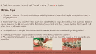 4. Cinch the crimp onto the push rod. This will provide 1.5 mm of activation.
Clinical Tips
1. If greater than the 1.5 mm of activation provided by one crimp is required, replace the push rod with a
longer push rod.
2. Reactivation may only be achieved on push rods sizes that have stops. Since the 22 mm push rod does not
have a stop, use the 22 mm push rod to do initial advancement, and then replace it with a 25 mm push rod
when there is adequate space.
3. Usually one split crimp per appointment will be needed, exclusions include non-growing patients.
4. The Forsus device can be activated unilaterally, which helps with midline control.
5. When additional activation is needed, repositioning the push rod from the cuspid to first bicuspid is also
an option.
Vogt W. The Forsus fatigue resistant device. Journal of clinical orthodontics: JCO. 2006
 