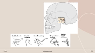 presentation title 28
20XX
 