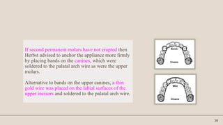38
If second permanent molars have not erupted then
Herbst advised to anchor the appliance more firmly
by placing bands on the canines, which were
soldered to the palatal arch wire as were the upper
molars.
Alternative to bands on the upper canines, a thin
gold wire was placed on the labial surfaces of the
upper incisors and soldered to the palatal arch wire.
 