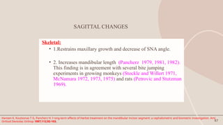 47
SAGITTAL CHANGES
Skeletal:
• 1.Restrains maxillary growth and decrease of SNA angle.
• 2. Increases mandibular length (Pancherz 1979, 1981, 1982).
This finding is in agreement with several bite jumping
experiments in growing monkeys (Stockle and Willert 1971,
McNamara 1972, 1973, 1975) and rats (Petrovic and Stutzman
1969).
Hansen K, Koutsonas T G, Pancherz H. l~ong-term effects of Herbst treatment on the mandibular incisor segment: a cephalometric and biometric investigation. AmJ
Orthod Dentolac Orthop 1997;112;92-103.
 