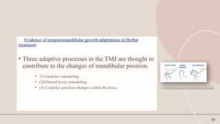 48
Evidence of temporomandibular growth adaptations in Herbst
treatment:
• Three adaptive processes in the TMJ are thought to
contribute to the changes of mandibular position.
• 1) Condylar remodeling.
• (2)Glenoid fossa remodeling;
• (3) Condylar position changes within the fossa.
 