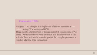 51
Paulsen et al (1995) :
Analysed TMJ changes in a single case of Herbst treatment in late
puberty using CT scanning and OPG.
Three months after insertion of the appliance CT-scanning and OPGs
of the TMJ revealed new bone formation as a double contour in the
articular fossa and on the posterior part of the condylar process as a
result of adaptive bone remodeling.
 