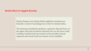 54
Dental effects in Saggital direction
Dental changes seen during Herbst appliance treatment are
basically a result of anchorage loss in the two dental arches.
The telescope mechanism produces a posterior directed force on
the upper teeth and an anterior directed force on the lower teeth,
resulting in distal tooth movements in the maxillary buccal
segments and mesial tooth movements in the mandible.
 