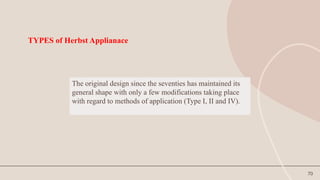 70
TYPES of Herbst Applianace
The original design since the seventies has maintained its
general shape with only a few modifications taking place
with regard to methods of application (Type I, II and IV).
 