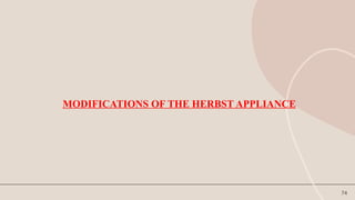 74
MODIFICATIONS OF THE HERBST APPLIANCE
 