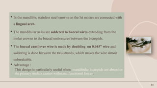 84
 In the mandible, stainless steel crowns on the Ist molars are connected with
a lingual arch.
 The mandibular axles are soldered to buccal wires extending from the
molar crowns to the buccal embrasures between the bicuspids.
 The buccal cantilever wire is made by doubling on 0.045” wire and
soldering is done between the two strands, which makes the wire almost
unbreakable.
 Advantage :
This design is particularly useful when mandibular bicuspids are absent or
the primary molars cannot withstand functional forces.
 