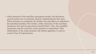 87
• After intrusion of the maxillary permanent molars, the deciduous
second molars are in occlusion, thereby maintaining the bite open.
When intrusion is completed, the Herbst rods and tubes are attached to
the intruded maxillary first molars, while extraction of the maxillary
deciduous first and second molars should follow. Thus, the mandible
autorotates and the maxillary molar position is maintained. After
stabilization of the molar position, the Herbst appliance is used to
correct Class II malocclusion.
 