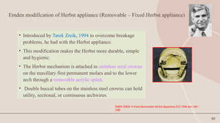 89
Emden modification of Herbst appliance (Removable – Fixed Herbst appliance)
• Introduced by Tarek Zreik, 1994 to overcome breakage
problems, he had with the Herbst appliance.
• This modification makes the Herbst more durable, simple
and hygienic.
• The Herbst mechanism is attached to stainless steel crowns
on the maxillary first permanent molars and to the lower
arch through a removable acrylic splint.
• Double buccal tubes on the stainless steel crowns can hold
utility, sectional, or continuous archwires.
TAREK ZREIK: A Fixed-Removable Herbst Appliance JCO 1994 Apr 246 –
248)
 