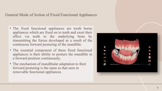 9
General Mode of Action of Fixed Functional Appliances
• The fixed functional appliances are tooth borne
appliances which are fixed on to teeth and exert their
effect via teeth to the underlying bone by
transmitting the forces developed as a result of the
continuous forward posturing of the mandible.
• The essential component of these fixed functional
appliances is their ability to posture the mandible in
a forward position continuously.
• The mechanism of mandibular adaptation to their
forward posturing is the same as that seen in
removable functional appliances.
 