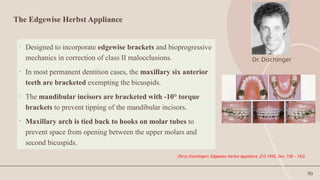 90
The Edgewise Herbst Appliance
• Designed to incorporate edgewise brackets and bioprogressive
mechanics in correction of class II malocclusions.
• In most permanent dentition cases, the maxillary six anterior
teeth are bracketed exempting the bicuspids.
• The mandibular incisors are bracketed with -10° torque
brackets to prevent tipping of the mandibular incisors.
• Maxillary arch is tied back to hooks on molar tubes to
prevent space from opening between the upper molars and
second bicuspids.
(Terry Dischingerl: Edgewise Herbst Appliance JCO 1995, Dec: 738 – 742)
Dr. Dischinger
 