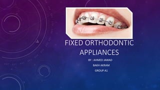 FIXED ORTHODONTIC
APPLIANCES
BY : AHMED JAWAD
BAKH AKRAM
GROUP A1
 